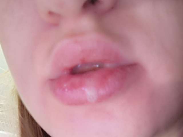MARTAKISS free sexy photo